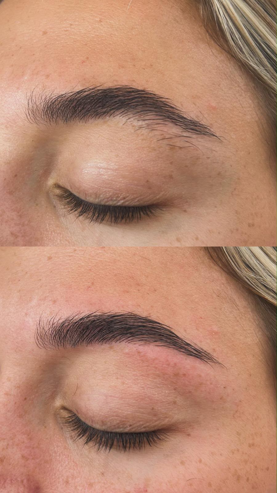 Brow transformation